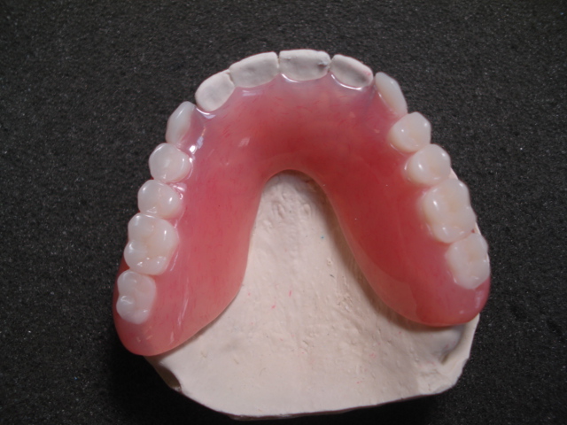 Streamline Dental Lab - Manhattan, New York - Gallery - Dentures ...