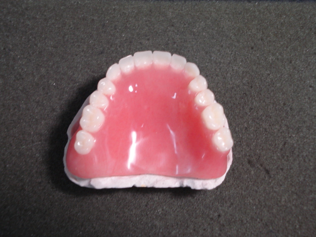 Streamline Dental Lab - Manhattan, New York - Gallery - Dentures - Full ...