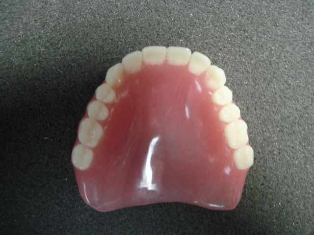 Streamline Dental Lab - Manhattan, New York - Gallery - Dentures - Full ...